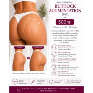 Buttock Augmentation Filler (BBL) – 500ml
